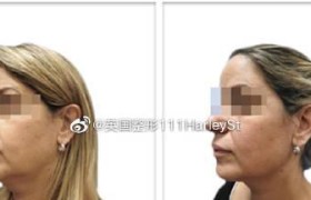 英国整容（探索英国整容行业的发展趋势与质量保证）